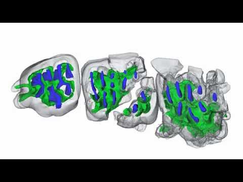 Virtual reconstruction of cranium of Vintana sertichi (IV)