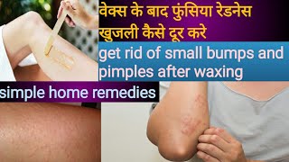wax krne ke bad dane redness itching hoti h use kese thik kre|HOW TO GET RID OF SMALL BUMP AFTER WAX