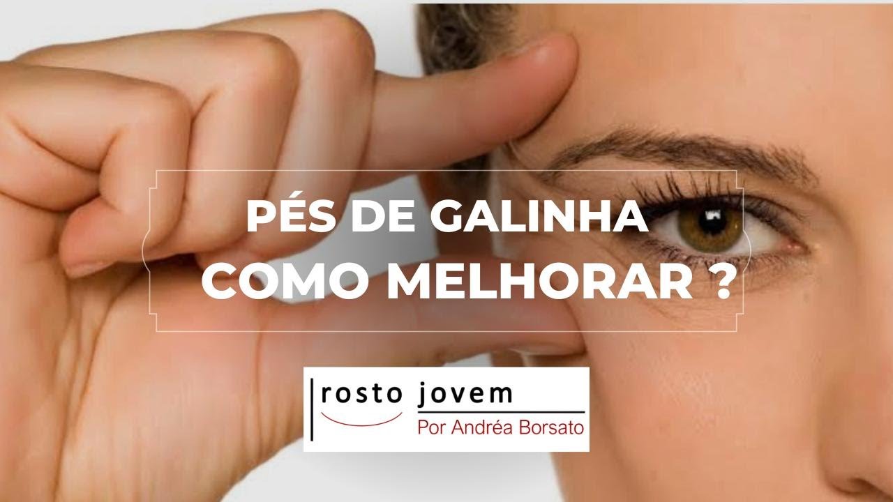 Pés de galinha - como melhorar