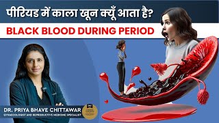 पीरियड में काला खून क्यों आता है ? By Dr. Priya Bhave Chittawar