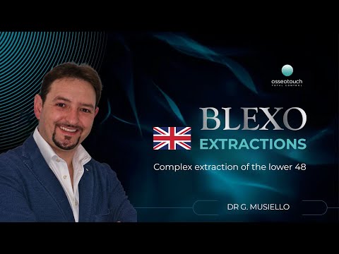 BLEXO clinical case — complex extraction lower #48