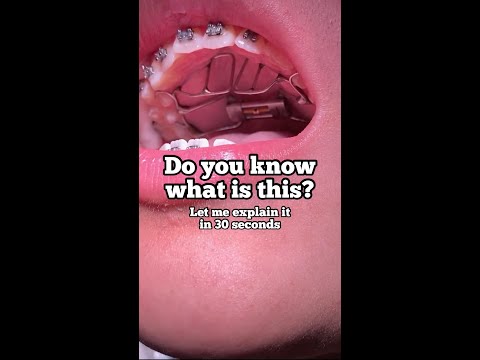 how does Thumb Sucking affect teeth? Tooth Time Family Dentistry