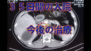 【大腸がんステージⅣ多発肝転移】初めての手術失敗！後悔はない！今後の治療は・・・？【現在闘病中㉙】