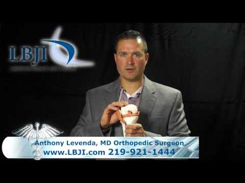 Dr. Anthony Levenda Explains ACL Tears and Repair
