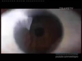 Iklan Torabika Dou