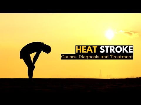 Heat Stroke, Causes, Signs and Symptoms, Diagnosis and Treatment.