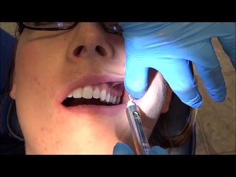 PSA Injection (PART 2)