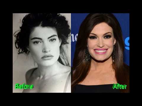 download lagu mp3 mp4 Kimberly Guilfoyle Plastic Surgery, download lagu Kimberly Guilfoyle Plastic Surgery gratis, unduh video klip Kimberly Guilfoyle Plastic Surgery