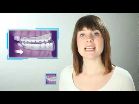 Funktionsweise der Narval CC