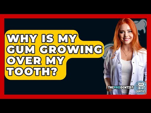 Why Is My Gum Growing Over My Tooth? - The Pro Dentist