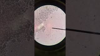 Download lagu Part 1: Toothbrush 🪥 microorganisms 1000x magnification mp3 Download lagu Part 1: Toothbrush 🪥 microorganisms 1000x magnification mp3