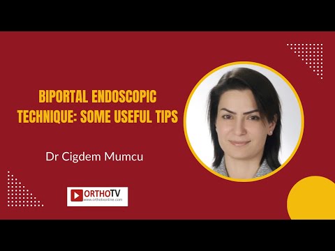 , title : 'Biportal Endoscopic Technique: Some Useful Tips - Dr Cigdem Mumcu'