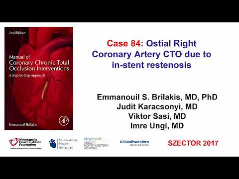 Case 84: Manual of CTO Interventions - Ostial right coronary artery CTO due to ISR