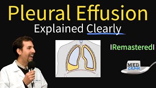 Download Lagu Pleural Effusions - Causes, Diagnosis, Symptoms, Treatment Thumbnail