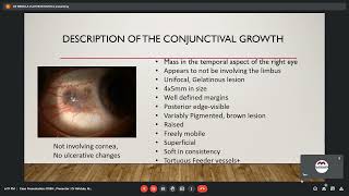 Case Presentation OSSN, Dr. Mridula Vijayaraghavan, 22 Nov 2021