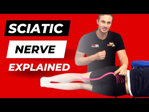 What is Sciatica and What Causes it? Sciatica Explained by a Physiotherapist.