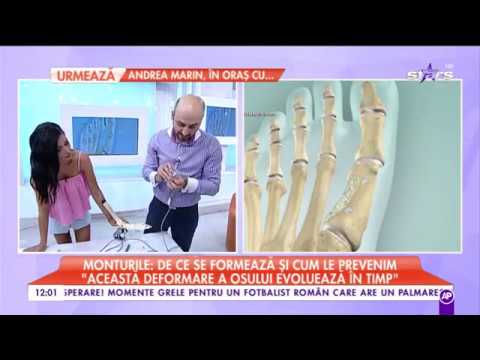 Tratamentul artritei și artrozei articulației șoldului