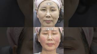 60대 피부과 시술, 효도 선물 이렇게 해보세요🌸