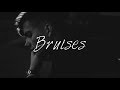 Lewis Capaldi - Bruises (Traduction)