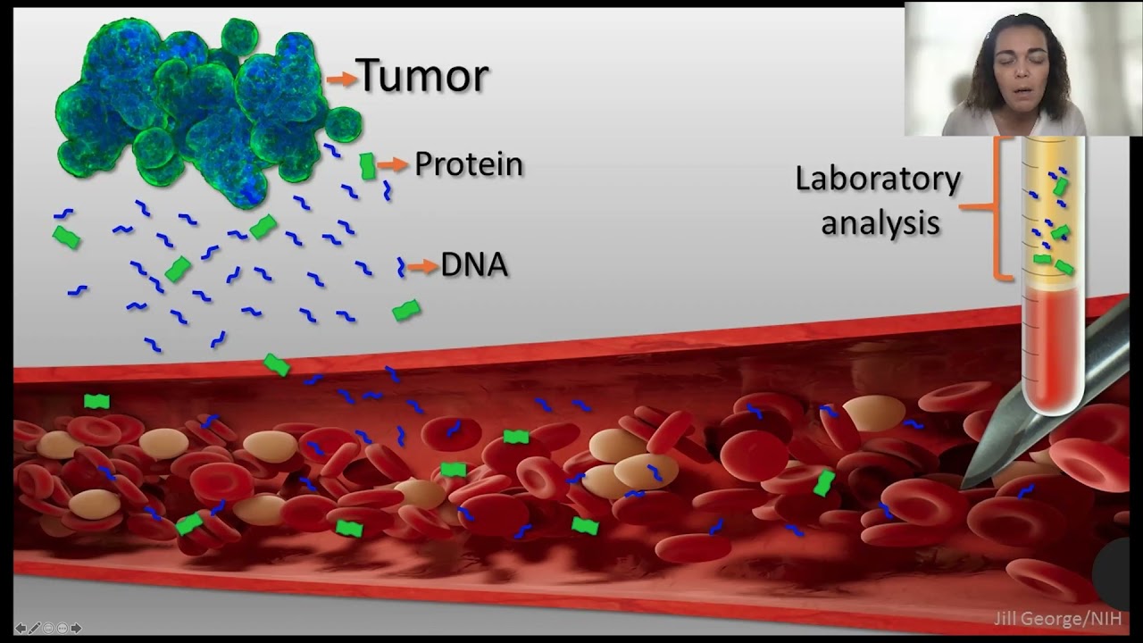Biomarkers and Liquid Biopsies by Bodour Salhia, PhD