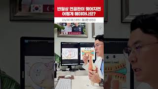 무비