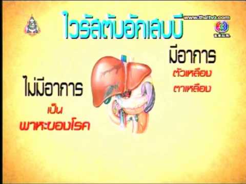 Tar ไม้เรียวจากกลาก Sambucus นิโกรโรคสะเก็ดเงิน