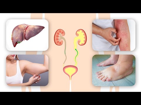 Constant Urge to Pee Here s Why