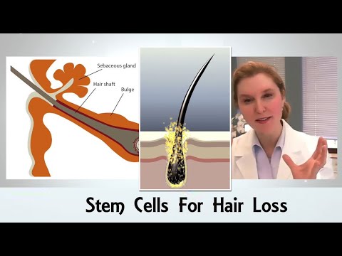 Stem Cell Therapy For Hair Loss - Get The Truth