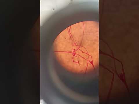 How to see Rhizopus under a microscope: hyphae, sporangia and spores #shorts  #viral  #microscope