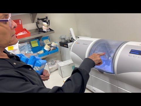 3D Printing My Tooth with a Sirona CEREC MC XL