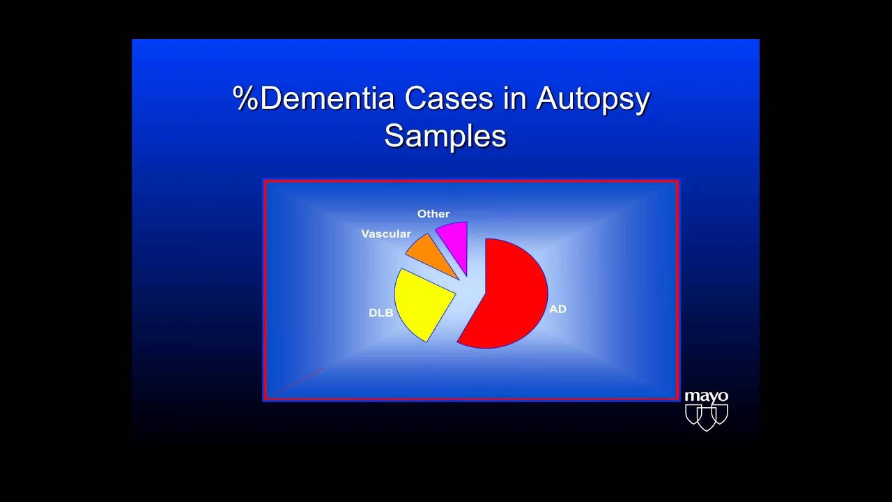 Understanding Behavioral Challenges in Lewy Body Dementia