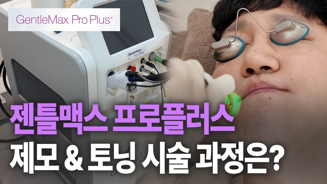 면도 후 트러블 벗어나고 싶어요 젠틀맥스 프로 플러스 체험기