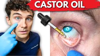 I Used 100% CASTOR OIL Eye Drops for 30 days - Here's What happened