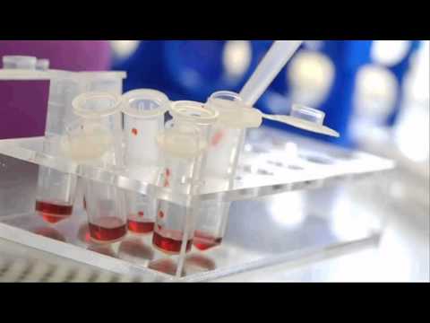 新的微流控技術，輕鬆做血液分析。 (New microfluidic technique for doing Blood Analysis easily.)