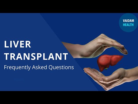 Liver Transplant - Frequently Asked Questions