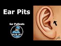 Ear Pits: Patient Education