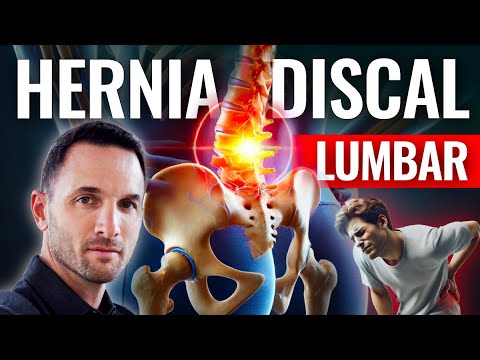 Herniated lumbar disc - waist pain and sciatica