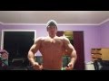 bodybuilding muscle flexing update night before hernia surgery