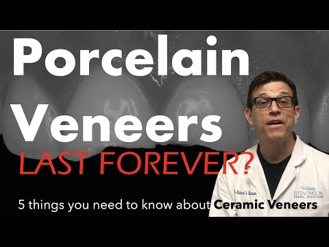 Five Things You Should Know About Ceramic Veneers