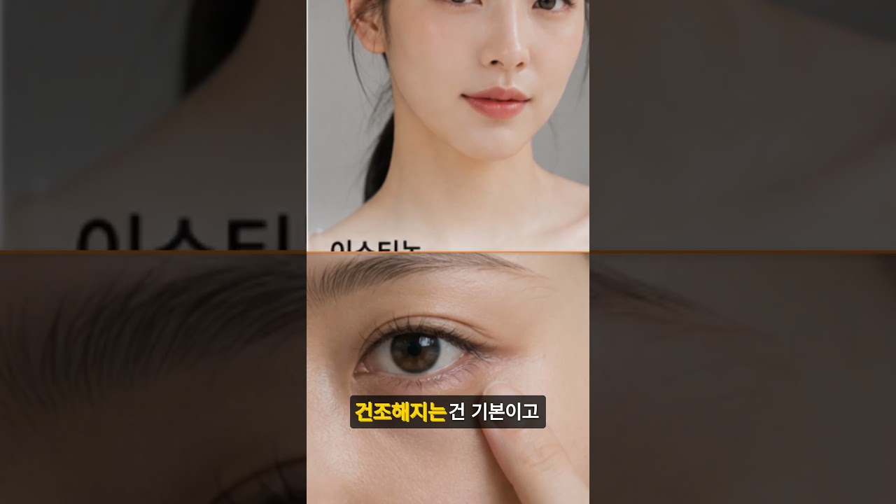 여드름 솔루션