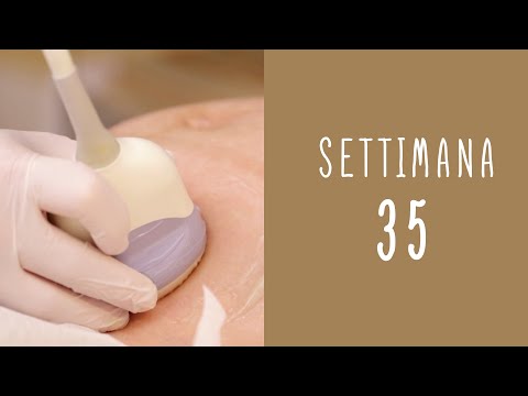 Calendario della gravidanza - settimana 35