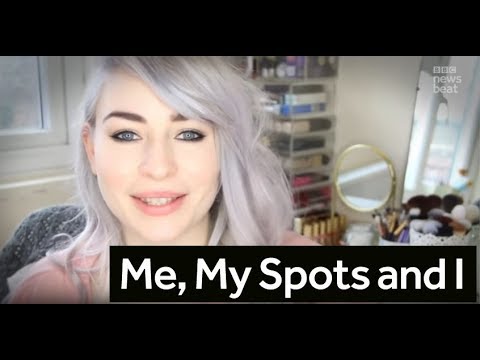 Me, My Spots and I | BBC Newsbeat