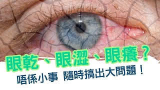 眼乾、眼澀、眼癢？唔係小事 隨時搞出大問題！