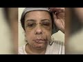 New Jersey Woman Who Fought For Her Life During Trip To Turks And Caicos Hopes To Warn Travelers