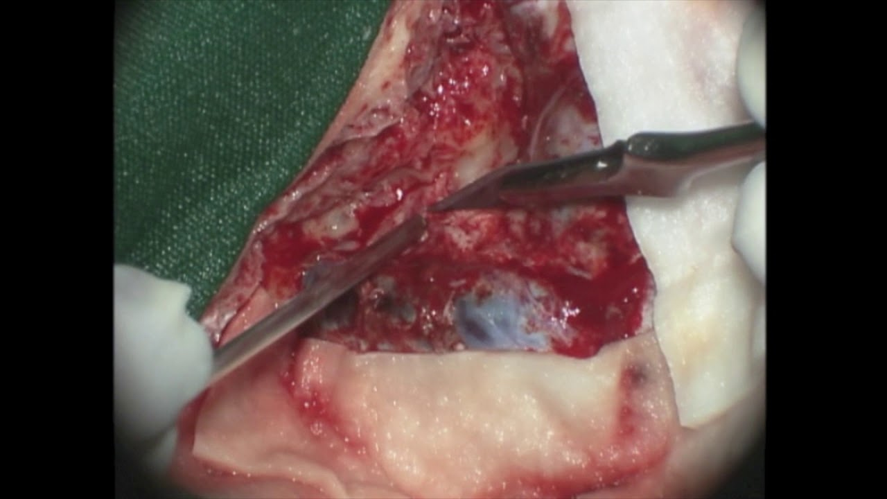 Jean G. De Oliveira-23