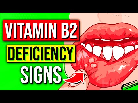 7 Signs You Have A Vitamin B2 Deficiency & 7 Health Benefits!