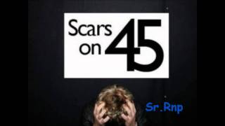 Scars On 45 - Beauty&#39;s Running Wild