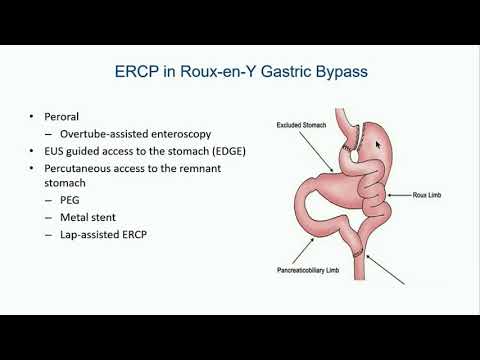 2018 Post-DDW - Controversies in Advanced Endoscopy Part 2