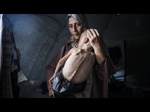 Certain images coming out of Gaza deemed ‘fake’ after media outlets use it as ‘propaganda’