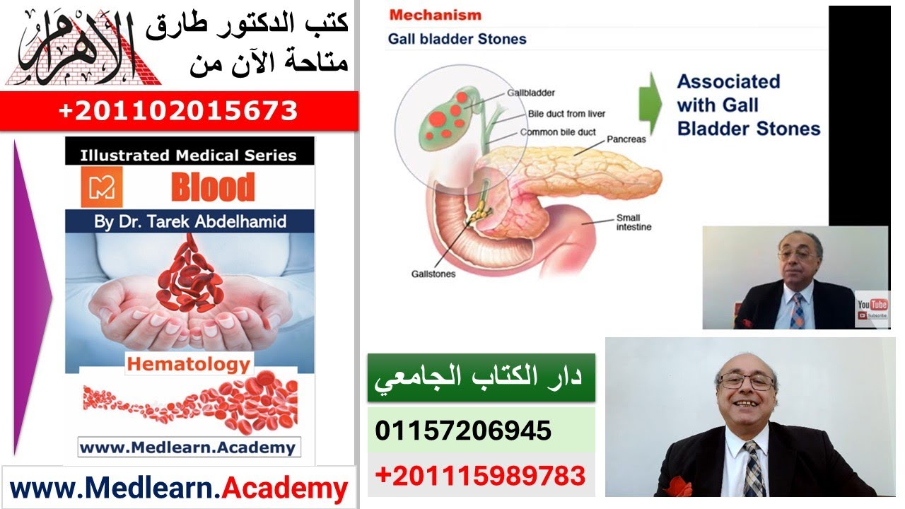 Hereditary Spherocytosis   #cme #internal_medicine #medical #usmle #محاضرات_باطنة #USMLE